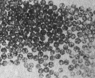 Это листовидная колония коралла из рода Turbinaria, изображенная крупным планом. Расправленные полипы, способные захватывать частички пищи, занимают на ней всего лишь четверть поверхности. Остальные три четверти покрыты слоем ткани, наполненной клетками водорослей бурого цвета. Эти водоросли за счет интенсивного фотосинтеза дают симбиотической системе коралл - водоросли больше энергии, чем сами полипы, ловящие планктон. Интересно, что у многих мадрепоровых кораллов, живущих на таких глубинах, куда проникает мало света, соотношение площади колонии, которая занята полипами, ловящими планктон, и площади, которая приходится на слой ткани, связывающей полипы между собой и содержащей фотосинтезирующие симбиотические водоросли, явно не в пользу полипов. Это свидетельствует о важной роли, которую играет свет в жизни кораллов