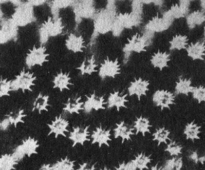 Фрагмент щупальца кораллового полипа. При сильном увеличении видны содержащиеся в его тканях зооксантеллы. Каждый шарик представляет собой одноклеточную водоросль, причем некоторые из них, имеющие форму гантелей, находятся в процессе деления. Диаметр каждой клетки - около 0,01 мм. Эти крошечные симбиотические клетки - наиболее значительная составная часть растительной жизни на рифе