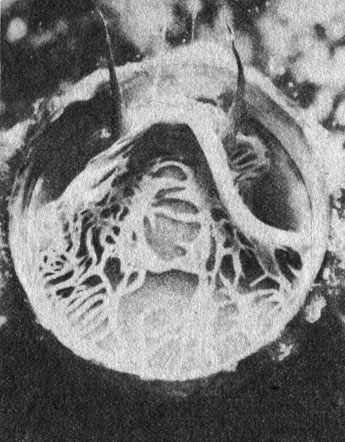 Удивительный брюхоногий моллюск Vermetus maximus, питающийся взвесью, обладает трубчатой раковиной, которая врастает в субстрат. На снимке видны голова и щупальца моллюска, выглядывающие из устья раковины. Животное забрасывает в поток воды 'сеть' из липких нитей слизи и, дождавшись, когда к ней пристанут частички пищи, втягивает ее обратно в раковину и съедает вместе с добычей