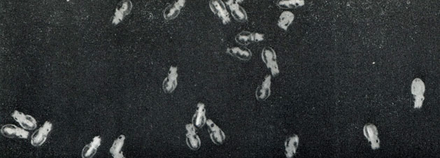 Вверху: новорожденные осьминоги (увеличено примерно вдвое)